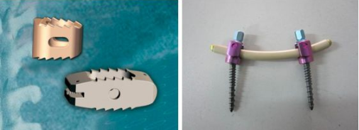 【爱游戏（中国）机械】从医疗看PEEK材料的应用及前景