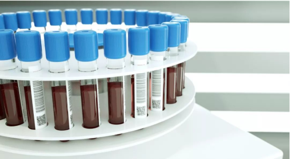 【爱游戏（中国）机械】血常规检测演化史之仪器的变迁