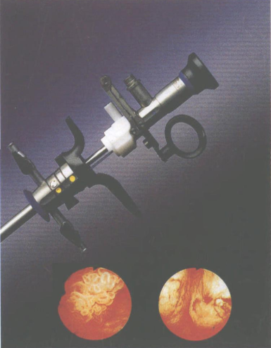 【爱游戏（中国）机械】经尿道切除镜